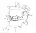 Fig. 01 - Expandable intervertebral implant