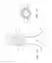 Fig. 09 - Fenestrated prosthesis