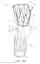 Fig. 49 - Fenestrated prosthesis