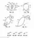 Fig. 07 - Devices and methods for controlled endoluminal filter deployment