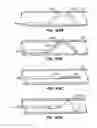 Fig. 35 - Devices and methods for controlled endoluminal filter deployment