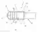 Fig. 02 - Orthopedic device for limiting the movement of a joint disposed between a first and a second body portion
