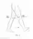 Fig. 08 - Controllable passive artificial knee