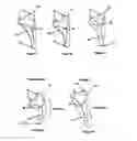 Fig. 09 - Ankle supports