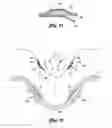 Fig. 06 - Goggle breathing system