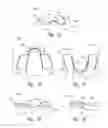 Fig. 02 - ORAL ORTHOSES AND ASSOCIATED DEVICES, SYSTEMS, AND METHODS