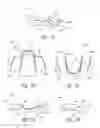Fig. 03 - ORAL ORTHOSES AND ASSOCIATED DEVICES, SYSTEMS, AND METHODS