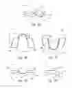 Fig. 04 - ORAL ORTHOSES AND ASSOCIATED DEVICES, SYSTEMS, AND METHODS