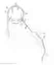 Fig. 07 - Variable stiffness cannula and methods for a surgical system
