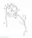 Fig. 08 - Variable stiffness cannula and methods for a surgical system