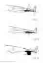 Fig. 02 - DEVICES AND METHODS FOR TREATING RESTLESS LEG SYNDROME