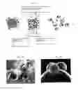 Fig. 02 - Microparticles supporting cells and active substances