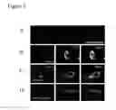 Fig. 07 - Compositions and methods for treating alzheimer's disease and other tauopathies