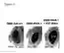 Fig. 13 - Compositions and methods for treating alzheimer's disease and other tauopathies
