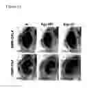 Fig. 17 - Compositions and methods for treating alzheimer's disease and other tauopathies