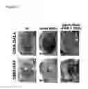 Fig. 19 - Compositions and methods for treating alzheimer's disease and other tauopathies