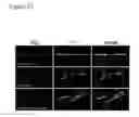 Fig. 22 - Compositions and methods for treating alzheimer's disease and other tauopathies