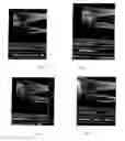 Fig. 02 - PREPARATION AND METHOD FOR THE PROPHYLAXIS AND TREATMENT OF OSTEOPOROSIS AND BONE FRACTURES
