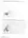 Fig. 27 - PHARMACEUTICAL COMPOSITION FOR TREATING HYPERPROLIFERATIVE DISEASES