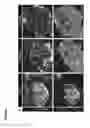 Fig. 02 - Methods and Compositions for Modulating Beta Cell Proliferation