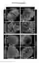 Fig. 08 - Methods and Compositions for Modulating Beta Cell Proliferation