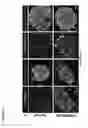 Fig. 32 - Methods and Compositions for Modulating Beta Cell Proliferation
