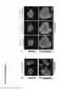 Fig. 33 - Methods and Compositions for Modulating Beta Cell Proliferation