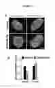 Fig. 40 - Methods and Compositions for Modulating Beta Cell Proliferation