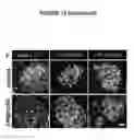 Fig. 41 - Methods and Compositions for Modulating Beta Cell Proliferation