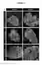 Fig. 45 - Methods and Compositions for Modulating Beta Cell Proliferation