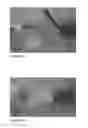 Fig. 05 - One component fibrin glue comprising zymogens