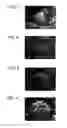 Fig. 02 - Composite particles which contain both cellulose and inorganic compound