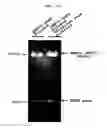 Fig. 13 - Microvesicles derived from cell protoplast and use thereof