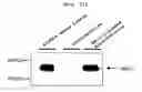 Fig. 22 - Microvesicles derived from cell protoplast and use thereof