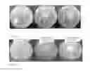 Fig. 02 - Smart, Self-Decontaminating Polymer and Method for Inhibiting The Growth Of A Bacteria and Fungus