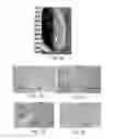 Fig. 03 - DISEASE TREATMENT VIA DEVELOPING NON-SYNGENEIC GRAFT TRANSPLANTATION