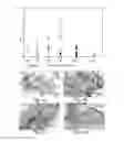 Fig. 04 - DISEASE TREATMENT VIA DEVELOPING NON-SYNGENEIC GRAFT TRANSPLANTATION