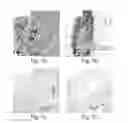 Fig. 07 - DISEASE TREATMENT VIA DEVELOPING NON-SYNGENEIC GRAFT TRANSPLANTATION
