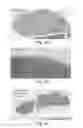 Fig. 08 - DISEASE TREATMENT VIA DEVELOPING NON-SYNGENEIC GRAFT TRANSPLANTATION