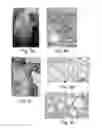Fig. 09 - DISEASE TREATMENT VIA DEVELOPING NON-SYNGENEIC GRAFT TRANSPLANTATION