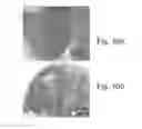 Fig. 10 - DISEASE TREATMENT VIA DEVELOPING NON-SYNGENEIC GRAFT TRANSPLANTATION