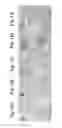 Fig. 12 - DISEASE TREATMENT VIA DEVELOPING NON-SYNGENEIC GRAFT TRANSPLANTATION