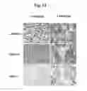 Fig. 14 - DISEASE TREATMENT VIA DEVELOPING NON-SYNGENEIC GRAFT TRANSPLANTATION