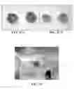 Fig. 12 - Collagen scaffolds, medical implants with same and methods of use
