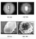 Fig. 14 - Collagen scaffolds, medical implants with same and methods of use