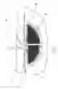 Fig. 06 - Wound cleansing apparatus