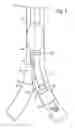 Fig. 03 - MULTI-LUMEN TRACHEAL TUBE WITH VISUALIZATION DEVICE