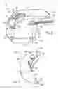 Fig. 05 - MULTI-LUMEN TRACHEAL TUBE WITH VISUALIZATION DEVICE
