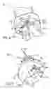 Fig. 07 - MULTI-LUMEN TRACHEAL TUBE WITH VISUALIZATION DEVICE