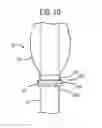 Fig. 08 - MULTI-LUMEN TRACHEAL TUBE WITH VISUALIZATION DEVICE